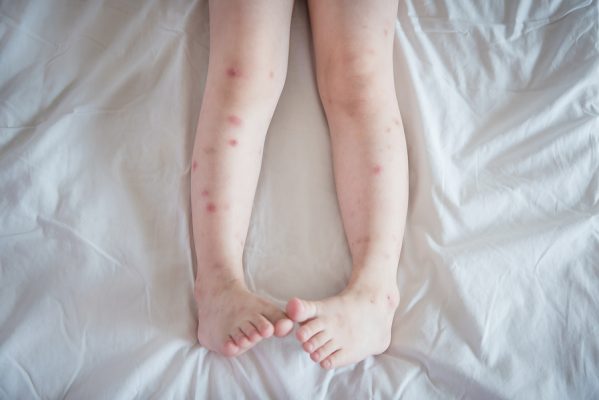 What to Do About Bed Bugs | Maine Bed Bugs & Pest Control