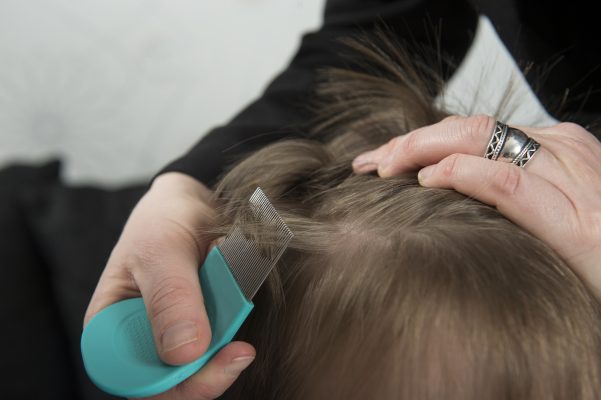 FDA-approved Treatments for Head Lice